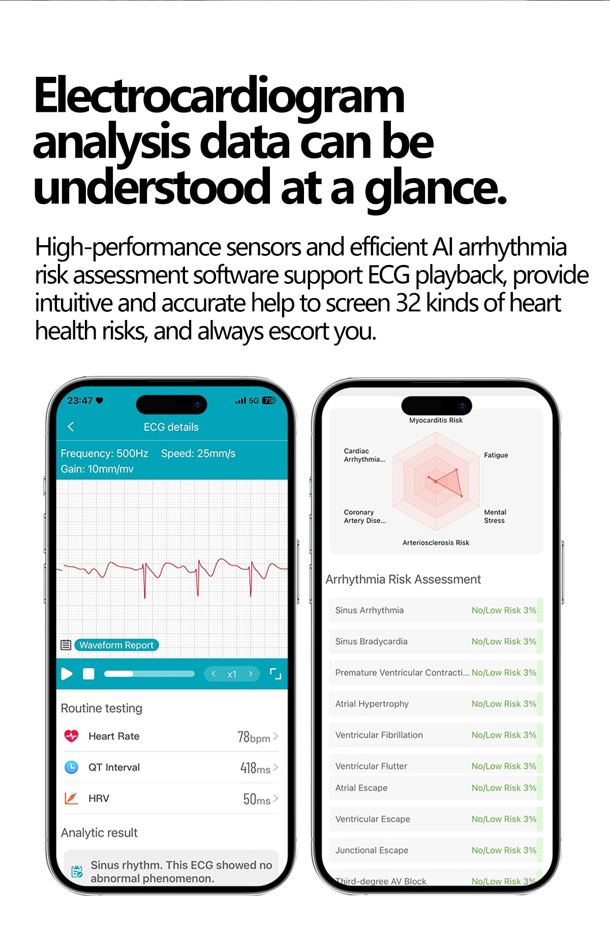SAYDIAN E8 Smart Watch, ECG Detection, Heart Rate Sleep Temperature Test, Bluetooth Call Fitness Watch — product detail 21